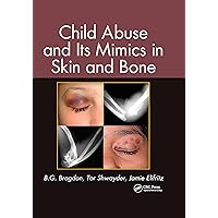 Child Abuse and its Mimics in Skin and Bone Child Abuse and its Mimics in Skin and Bone Hardcover Kindle Paperback