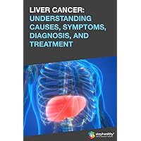LIVER CANCER: UNDERSTANDING CAUSES, SYMPTOMS, DIAGNOSIS, AND TREATMENT