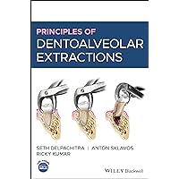 Principles of Dentoalveolar Extractions Principles of Dentoalveolar Extractions Hardcover Kindle