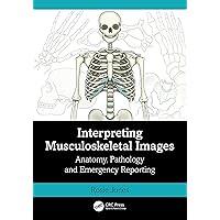 Interpreting Musculoskeletal Images: Anatomy, Pathology and Emergency Reporting Interpreting Musculoskeletal Images: Anatomy, Pathology and Emergency Reporting Paperback Kindle Hardcover
