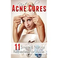 Natural Acne Cures Handbook: Simple & Natural Acne Treatments and Recipes for Acne. Cure and Prevent Acne Breakouts While Saving Money and Have Healthy Looking Skin..