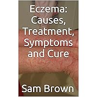 Eczema: Causes, Treatment, Symptoms and Cure