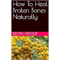 How To Heal Broken Bones Naturally