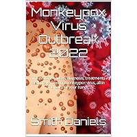 Monkeypox Virus Outbreak 2022: The history, causes, diagnosis, treatments and prevention of monkeypox virus, all in the palm of your hands.