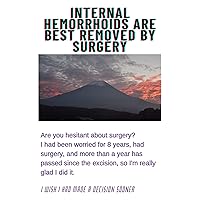 Internal hemorrhoids are best removed by surgery