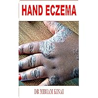 Dermatology: Hand Eczema or Irritant Contact Dermatitis (Skin Diseases Book 3)