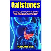 Gallstones : The Guide To Complete Knowledge About Gallstones, Treatments And Natural Remedies That Works Gallstones : The Guide To Complete Knowledge About Gallstones, Treatments And Natural Remedies That Works Kindle Paperback