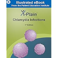 X-Plain ® Chlamydia Infections