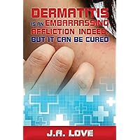 Dermatitis is an Embarrassing Affliction Indeed, but it can be Cured