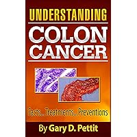 Colon Cancer - A Cancer Prevention and Cancer Cure Guide to Understanding the Facts of Colon Cancer for Treatment, Diet, and Nutrition