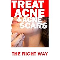TREAT ACNE & ACNE SCARS THE RIGHT WAY: Causes, no more acne cure, home remedies treatments, diet tips, acne care for clear and acne free skin for life, back, neck, chest, face pimples