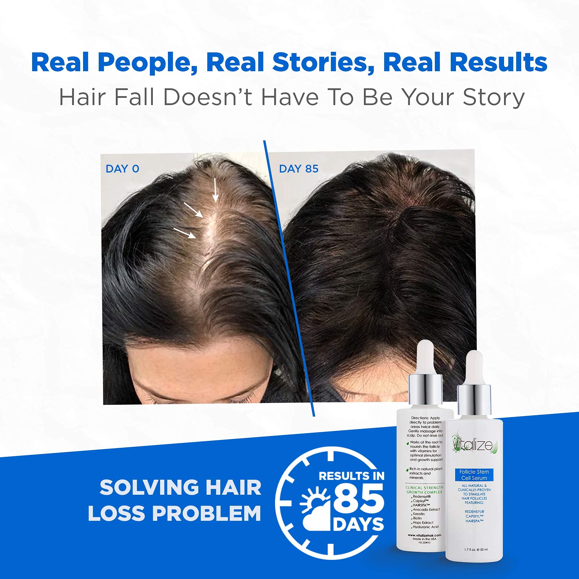 Mua Vitalize Hair - Follicle Stem Cell Serum with Redensyl, Capixyl, and  HairSpa, Hair Growth Serum for Hair Care and Scalp Treatment,  fl oz (50  ml) trên Amazon Mỹ chính hãng 2023 | Giaonhan247