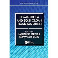 Dermatology and Solid Organ Transplantation (Series in Dermatological Treatment) Dermatology and Solid Organ Transplantation (Series in Dermatological Treatment) Hardcover Kindle