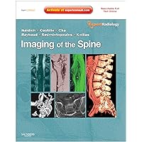 Imaging of the Spine: Expert Radiology Series, Expert Consult-Online and Print Imaging of the Spine: Expert Radiology Series, Expert Consult-Online and Print Hardcover Kindle