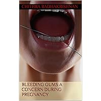 Bleeding Gums A Concern During Pregnancy Bleeding Gums A Concern During Pregnancy Kindle