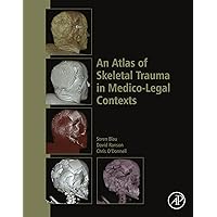 An Atlas of Skeletal Trauma in Medico-Legal Contexts An Atlas of Skeletal Trauma in Medico-Legal Contexts Kindle Hardcover