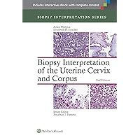 Biopsy Interpretation of the Uterine Cervix and Corpus (Biopsy Interpretation Series) Biopsy Interpretation of the Uterine Cervix and Corpus (Biopsy Interpretation Series) Hardcover Kindle