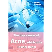 The true Causes of Acne, which only Insider know The true Causes of Acne, which only Insider know Kindle Paperback