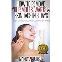 How To Remove Your Moles, Warts & Skin Tags in 3 Days: Easily, Naturally, And Without Surgery How To Remove Your Moles, Warts & Skin Tags in 3 Days: Easily, Naturally, And Without Surgery Kindle
