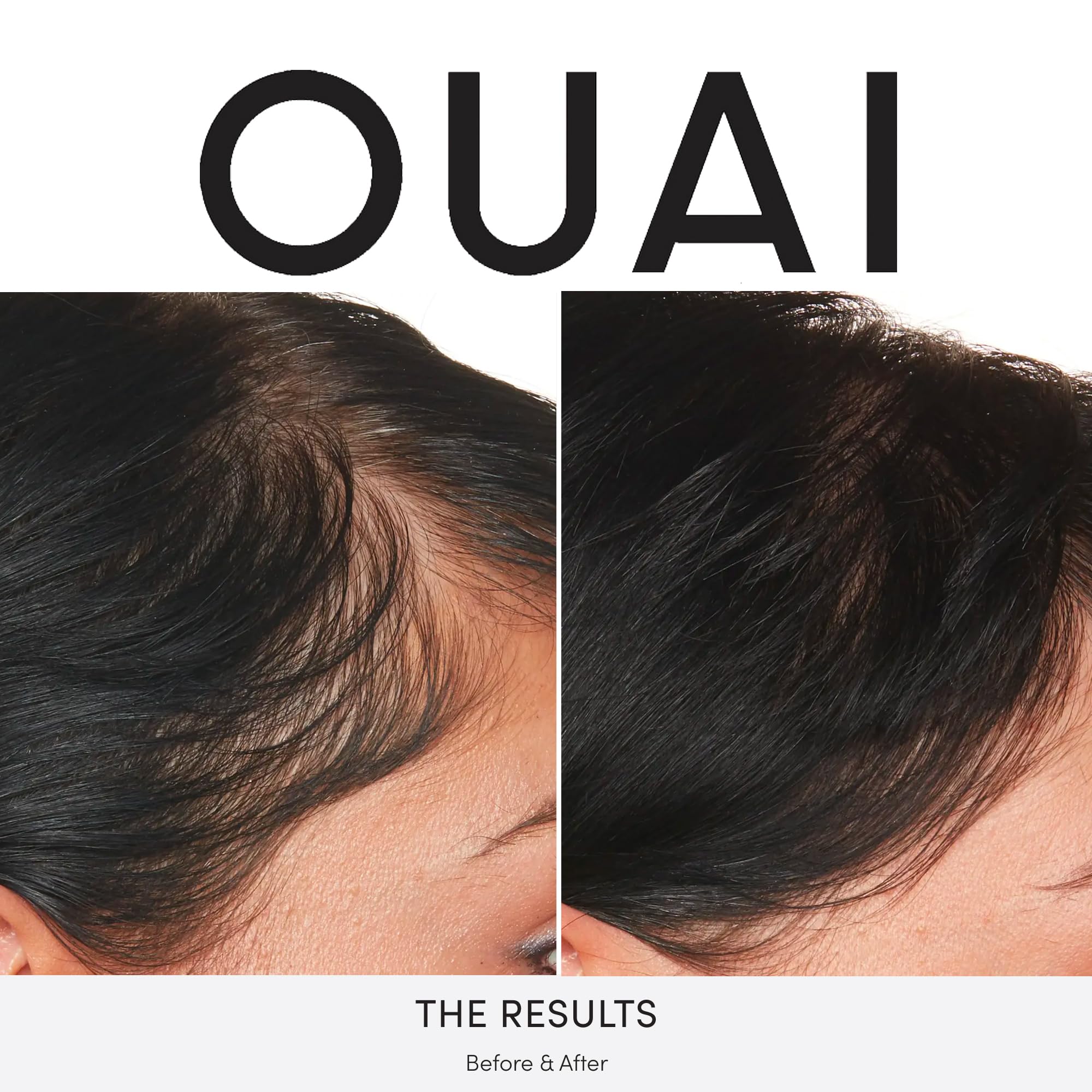 OUAI Scalp Serum - Balancing, Hydrating Formula for Thicker, Fuller-Looking Hair - 2 fl oz