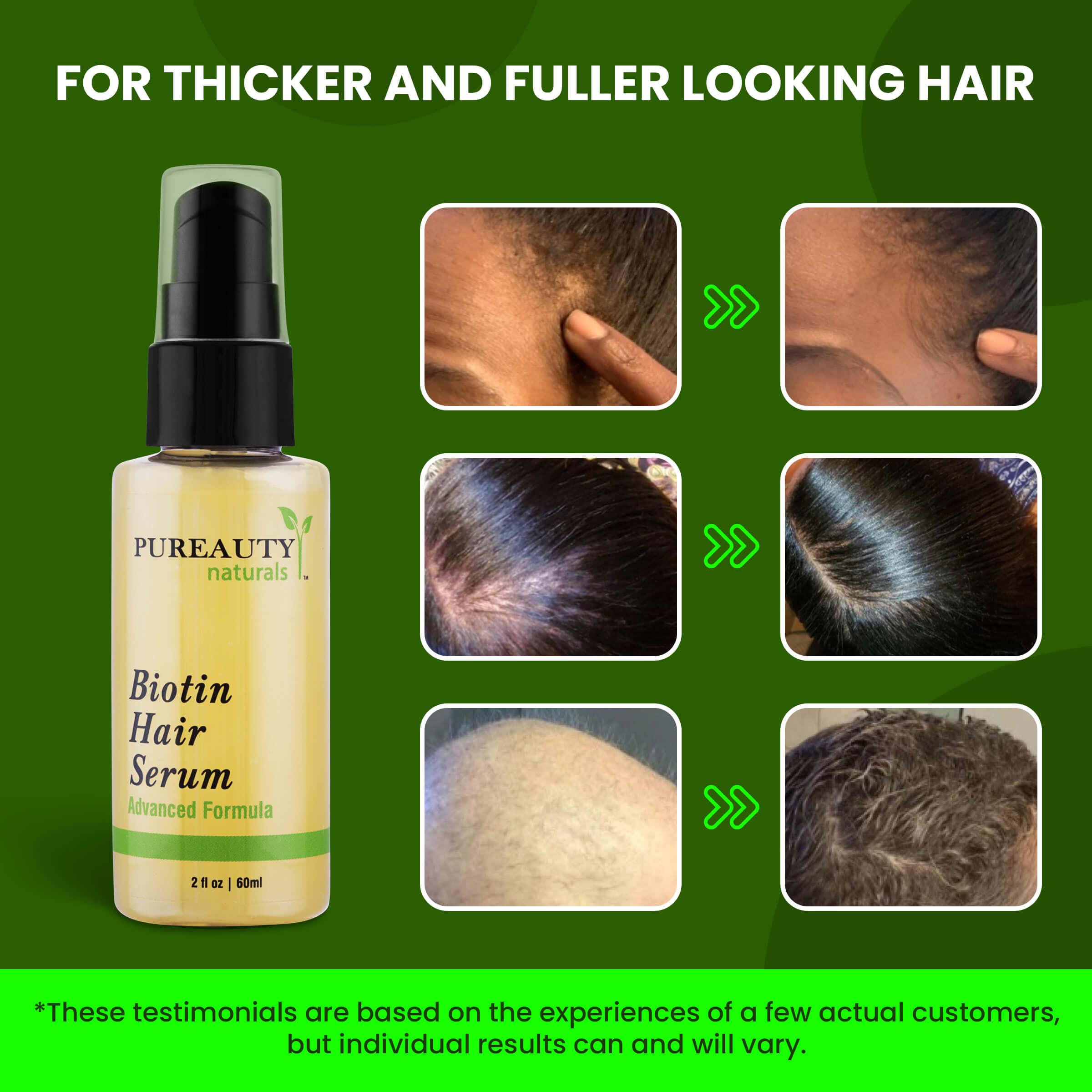 Mua Biotin Hair Growth Serum - Biotin serum & Hair growth oil and hair  serum - Topical hair growth product for thicker looking hair growth for  women & men hair loss serum -