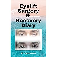 Eyelift Surgery and Recovery Diary: Ptosis, eyelifts, punctal plugs, and dry eyes Eyelift Surgery and Recovery Diary: Ptosis, eyelifts, punctal plugs, and dry eyes Kindle Audible Audiobook Hardcover Paperback