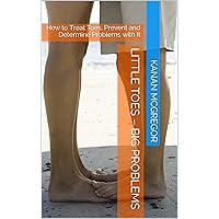 Little Toes – Big Problems: How to Treat Toes, Prevent and Determine Problems with Them