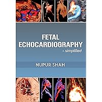 Fetal Echocardiography - Simplified Fetal Echocardiography - Simplified Kindle Paperback