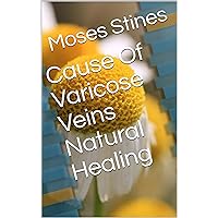 Cause Of Varicose Veins Natural Healing