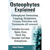 Osteophytes explained. Osteophytes Formation, Lipping, Symptoms, Causes, Exercises and Treatments all covered. Includes Cervical, Spine, Knee, Hand, Hip, Shoulder and Heel Osteophytes. Osteophytes explained. Osteophytes Formation, Lipping, Symptoms, Causes, Exercises and Treatments all covered. Includes Cervical, Spine, Knee, Hand, Hip, Shoulder and Heel Osteophytes. Kindle Paperback