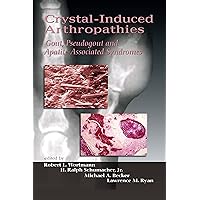 Crystal-Induced Arthropathies Crystal-Induced Arthropathies Hardcover