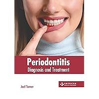 Periodontitis: Diagnosis and Treatment