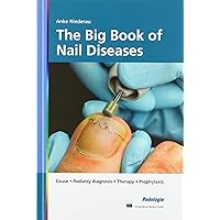 The Big Book of Nail Diseases: Cause, Podiatry diagnosis, Therapy, Prophylaxis