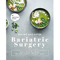 Before and After Bariatric Surgery: Delicious Recipes for Successful Weight Loss Before and After Bariatric Surgery: Delicious Recipes for Successful Weight Loss Kindle Paperback