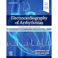 Electrocardiography of Arrhythmias: A Comprehensive Review: A Companion to Cardiac Electrophysiology Electrocardiography of Arrhythmias: A Comprehensive Review: A Companion to Cardiac Electrophysiology Paperback eTextbook