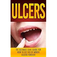 Ulcers: The Ultimate Cure Guide for How to Get Rid of Mouth Ulcers Instantly (Ulcer Free, Ulcer Diet, Mouth Ulcer Cure, Oral Ulcer) Ulcers: The Ultimate Cure Guide for How to Get Rid of Mouth Ulcers Instantly (Ulcer Free, Ulcer Diet, Mouth Ulcer Cure, Oral Ulcer) Kindle Audible Audiobook Paperback