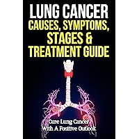 Lung Cancer Causes, Symptoms, Stages & Treatment Guide: Cure Lung Cancer With A Positive Outlook Lung Cancer Causes, Symptoms, Stages & Treatment Guide: Cure Lung Cancer With A Positive Outlook Kindle