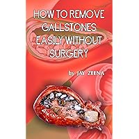 HOW TO REMOVE GALLSTONES EASILY WITHOUT SURGERY HOW TO REMOVE GALLSTONES EASILY WITHOUT SURGERY Kindle