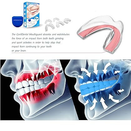 The ConfiDental - Pack of 5 Moldable Mouth Guard for Teeth Grinding Clenching Bruxism, Sport Athletic, Whitening Tray, Including 3 Regular and 2 Heavy Duty Guard (3 (lll) Regular 2 (II) Heavy Duty)