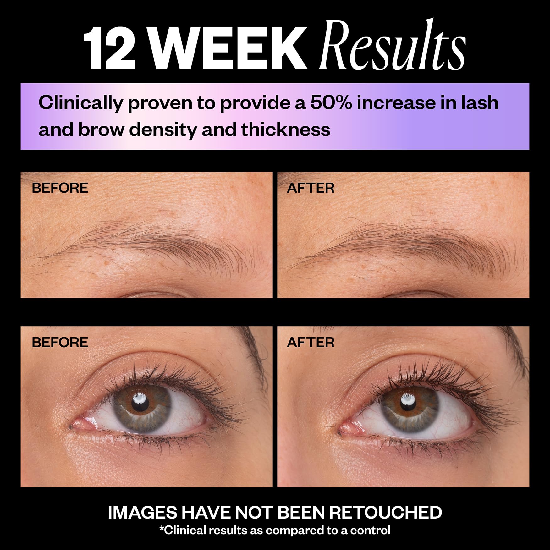 IGK Look Out Lash and Brow Boosting Peptide Serum | Increases Thickness + Fullness + Density of Brows and Lashes | Dermatologist + Ophthalmologist Approved | Vegan + Cruelty-Free | 0.11 Fl Oz