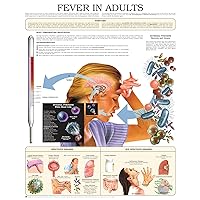 Fever in adults e chart: Full illustrated