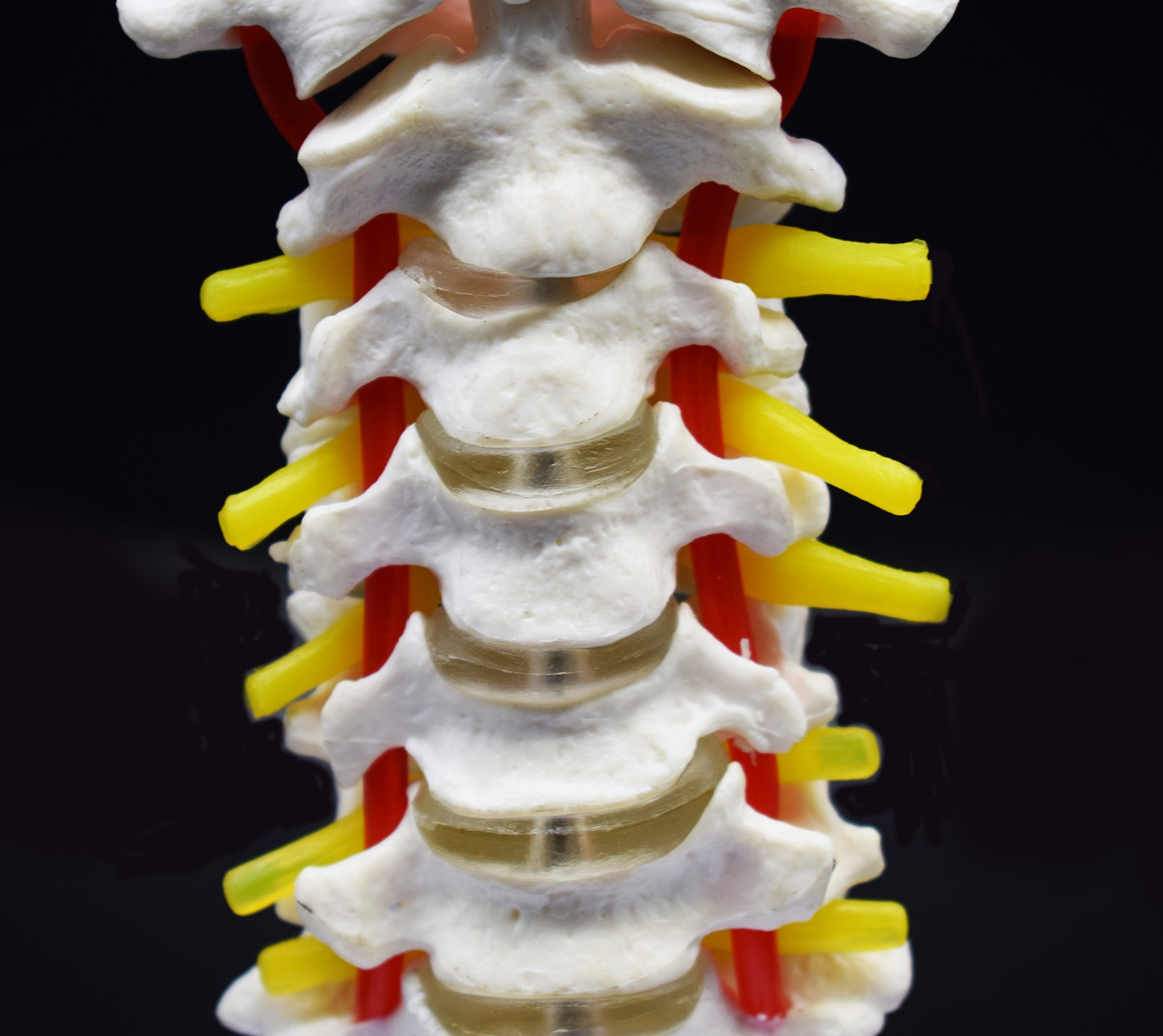 Mua Cervical Vertebra Arteria Spine Spinal Nerves Anatomical Model My Xxx Hot Girl 4881