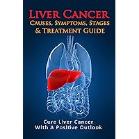 Liver Cancer Causes, Symptoms, Stages & Treatment Guide: Cure Liver Cancer With A Positive Outlook Liver Cancer Causes, Symptoms, Stages & Treatment Guide: Cure Liver Cancer With A Positive Outlook Kindle