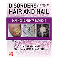 Disorders of the Hair and Nail: Diagnosis and Treatment Disorders of the Hair and Nail: Diagnosis and Treatment Paperback Kindle