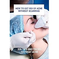 How To Get Rid Of Acne Without Scarring: 326 Tips And Tricks To Treat Acne: How To Remove Blackheads On Nose