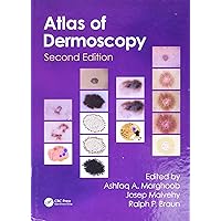 An Atlas of Dermoscopy An Atlas of Dermoscopy Hardcover