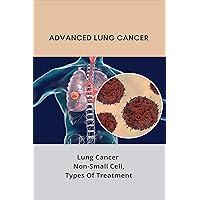 Advanced Lung Cancer: Lung Cancer - Non-Small Cell,Types Of Treatment: Lung Cancer Survival Rate Advanced Lung Cancer: Lung Cancer - Non-Small Cell,Types Of Treatment: Lung Cancer Survival Rate Kindle Paperback