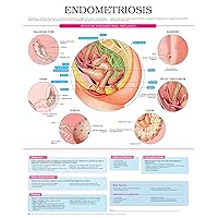 Endometriosis e chart: Full illustrated Endometriosis e chart: Full illustrated Kindle
