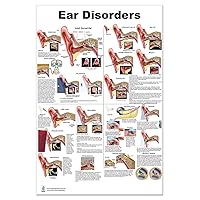 Ear Disorders Poster 24x36inch, Otitis and Other Disorders