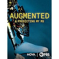 Augmented & Predicting My MS
